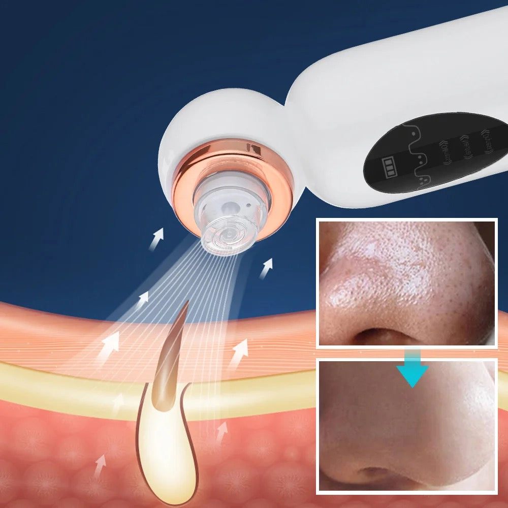 HydraFace Wand