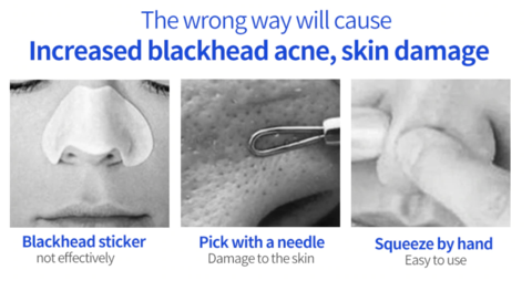 Blackhead Vacuum